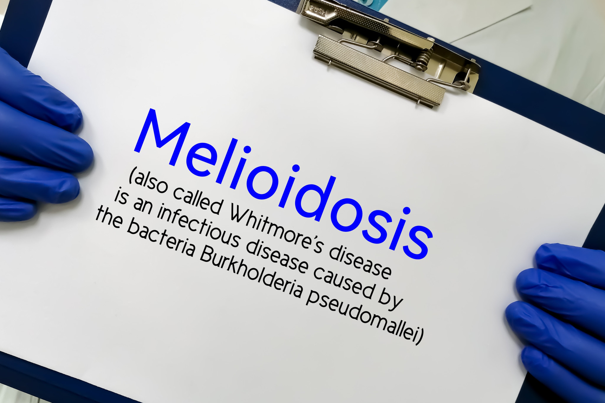 Two people have died from the dangerous melioidosis seasonal disease in the Far North.