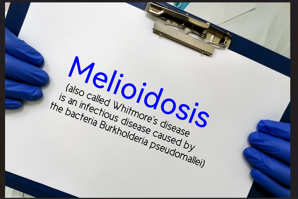 Residents are being warned about the highly dangerous meliodosis soil disease.